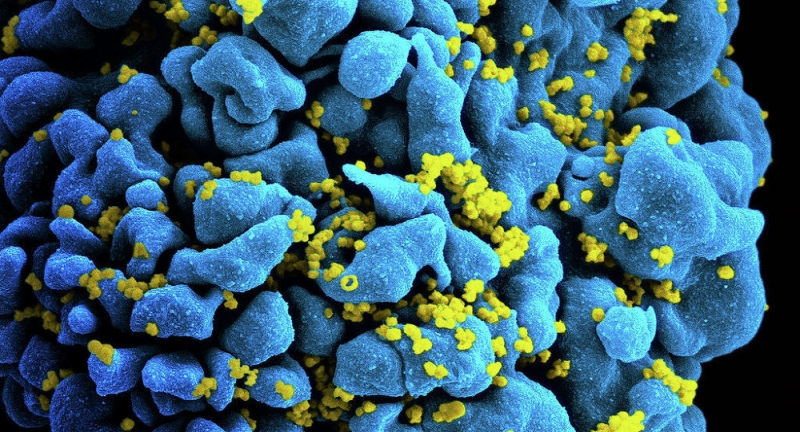 HIV VIRUS